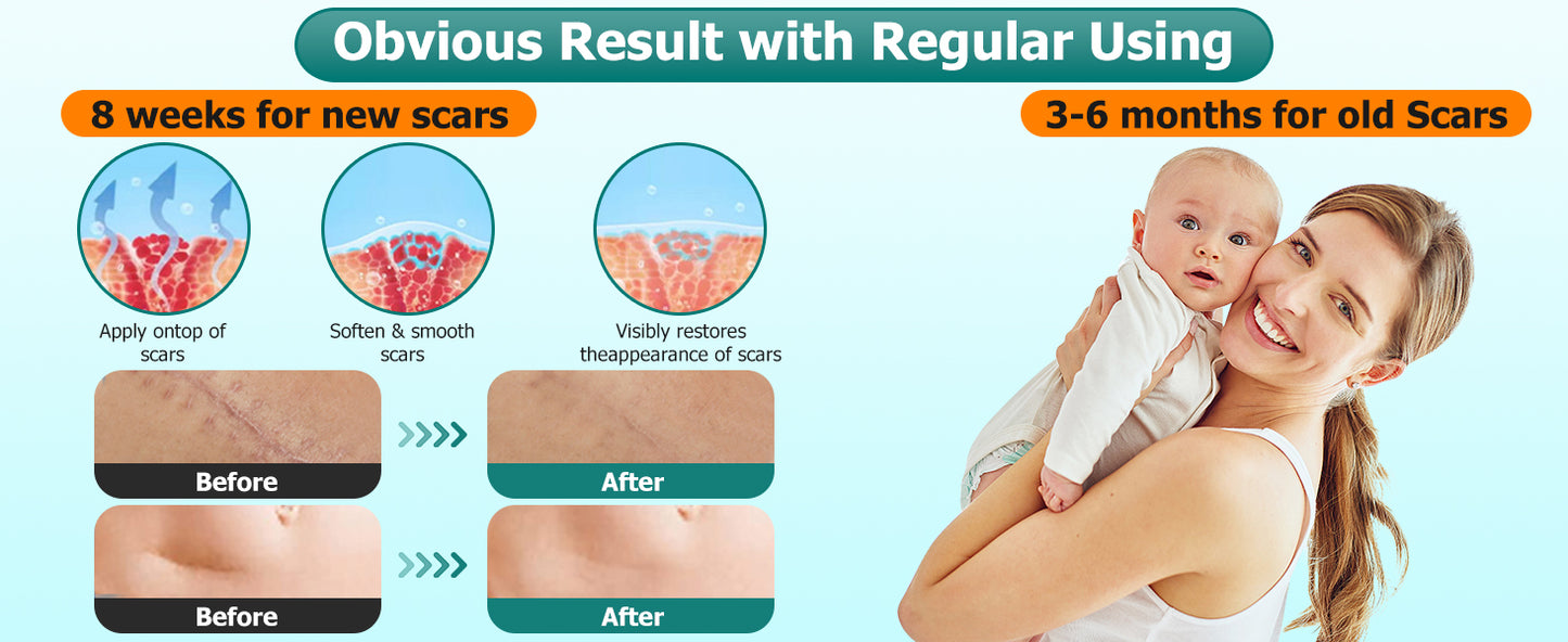 Scar Gel MOOYAM Advanced