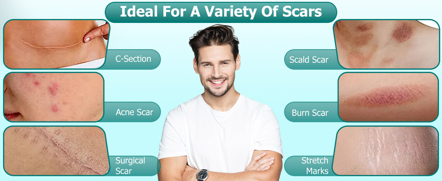 Scar Gel MOOYAM Advanced