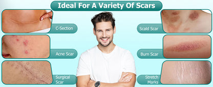 Scar Gel MOOYAM Advanced