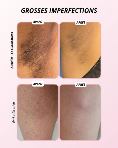 Gel orange exfoliant