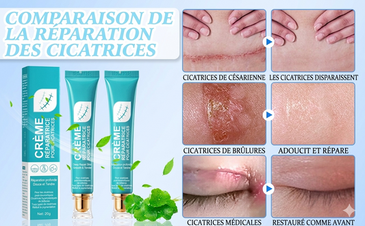 Repair Scar Cream
