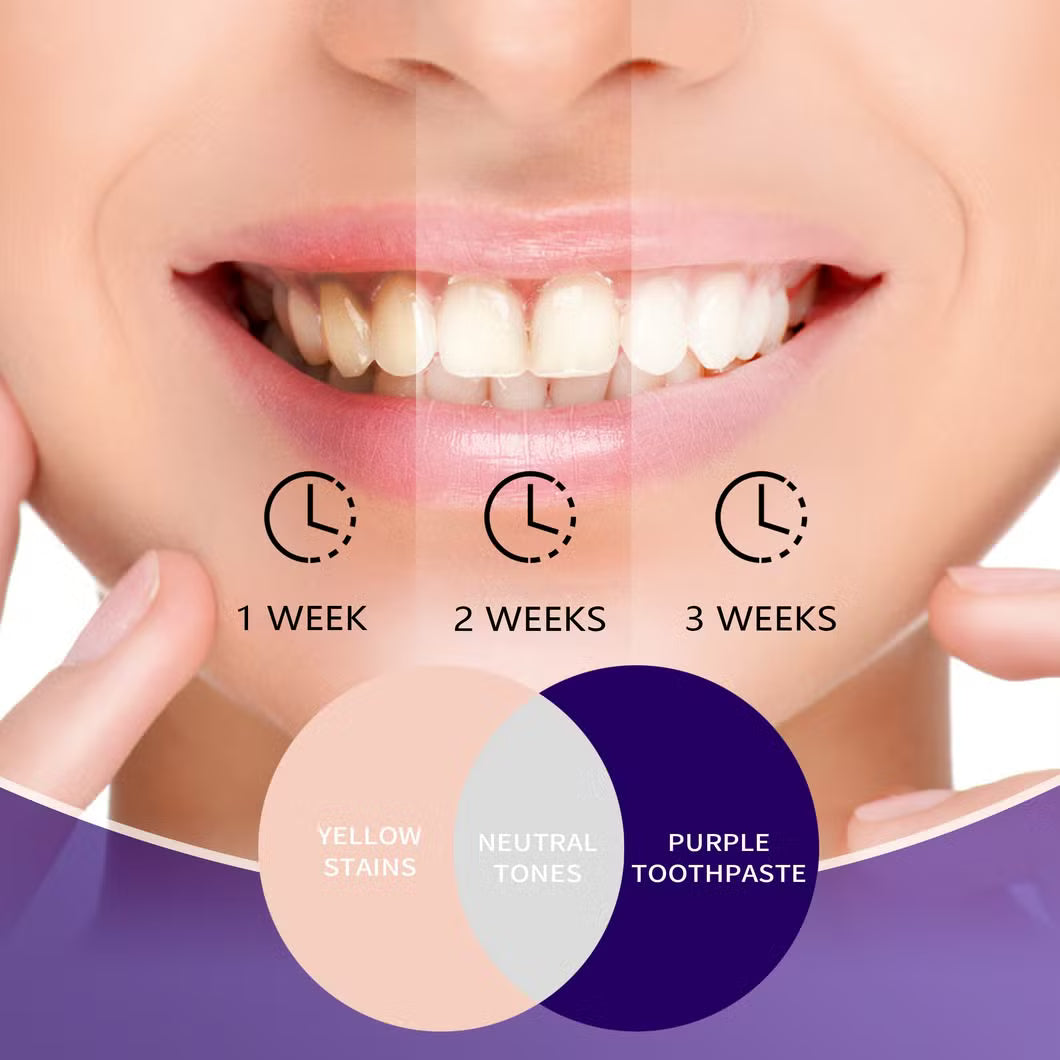 Glorysmile V34 Dentifrice