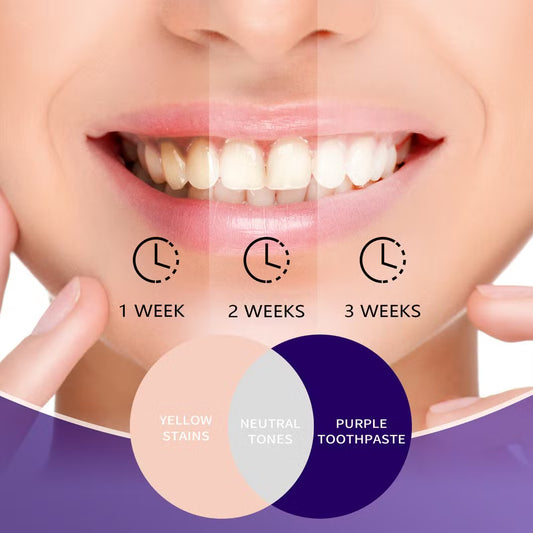 Glorysmile V34 Dentifrice